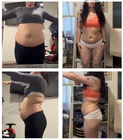 Client before and after, PCOS · 10 weeks