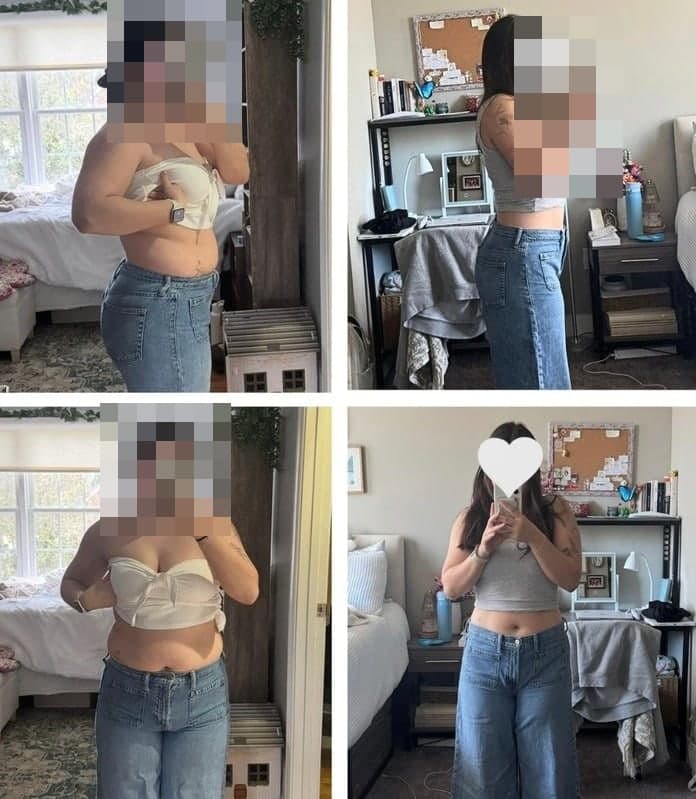Before and after photo