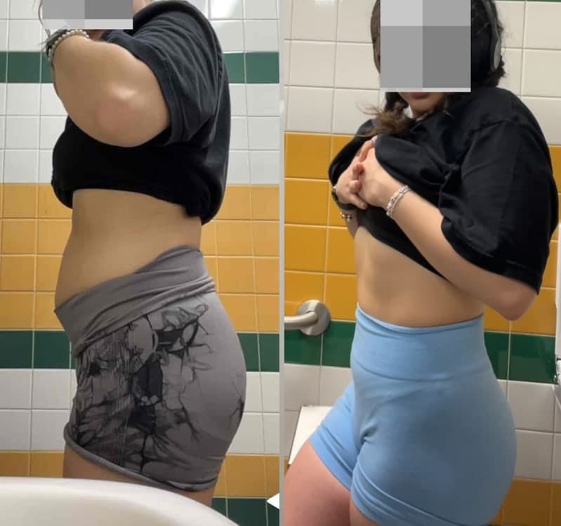 Before and after photo